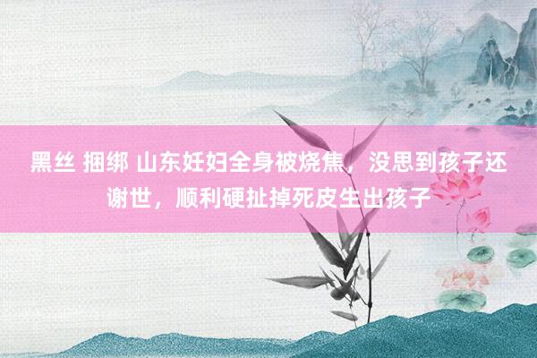 黑丝 捆绑 山东妊妇全身被烧焦，没思到孩子还谢世，顺利硬扯掉死皮生出孩子
